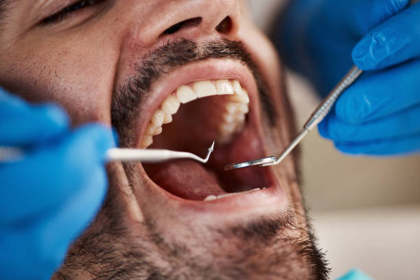 Best Emergency Treatment for Jaw Pain or Injury in Dogtown, CA